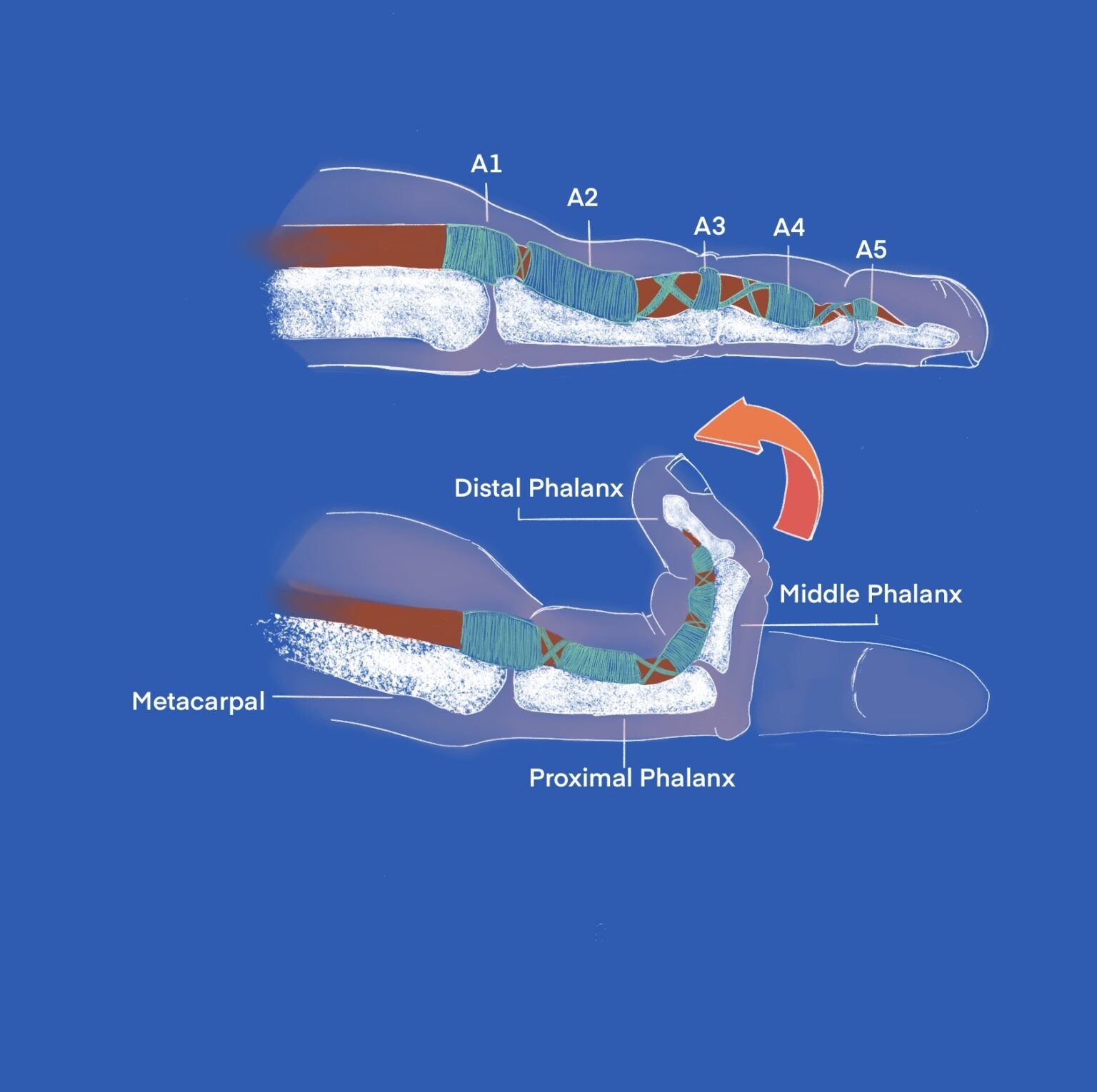 Finger Pulley Injuries and the Value of Taping